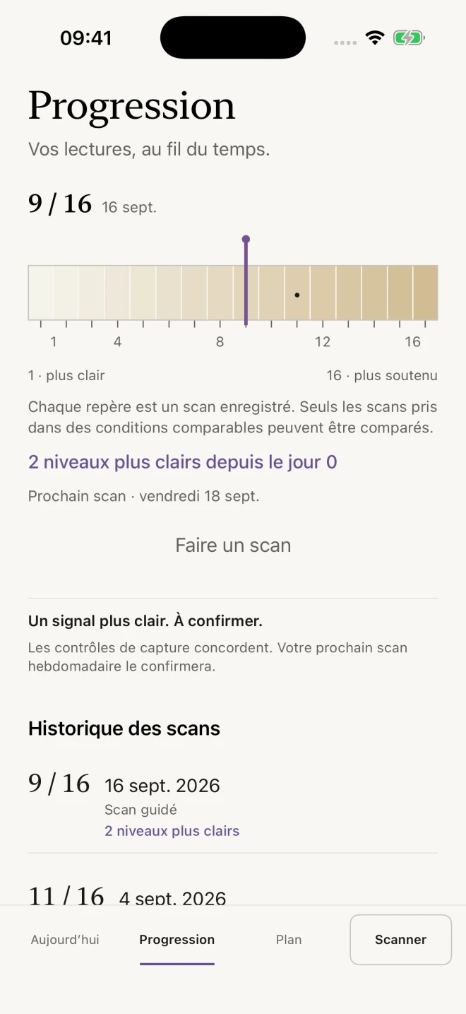 Enamel : suivi de la teinte et historique des scans